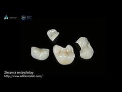 Transluzentes Zirkonia-Inlay für lang anhaltende Flecken- und Verschleißbeständigkeit