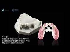 Biokompatibilität Zahnteleskop Weiß Inneres Zirkonia Außenblick Teleskop Zahn