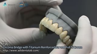 Fortschrittliche Zirkonoxid-Restaurationen im Dentallabor