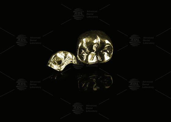 kaufen Edelmetall Gelbgold 60% Vollmetallkrone Gold Veredelung Vollmetallkrone Online-Herstellung