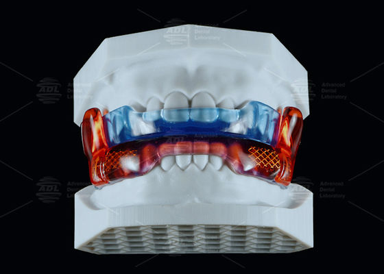 kaufen Medizinische Silikon Anti-Schnarchgerät RP zur Verbesserung des Schlafes Online-Herstellung