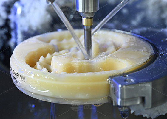 kaufen Entdecken Sie die Kraft des gefertigten vollständigen Zahners, ästhetisch ansprechend und natürlich aussehend für ein perfektes Lächeln. Online-Herstellung