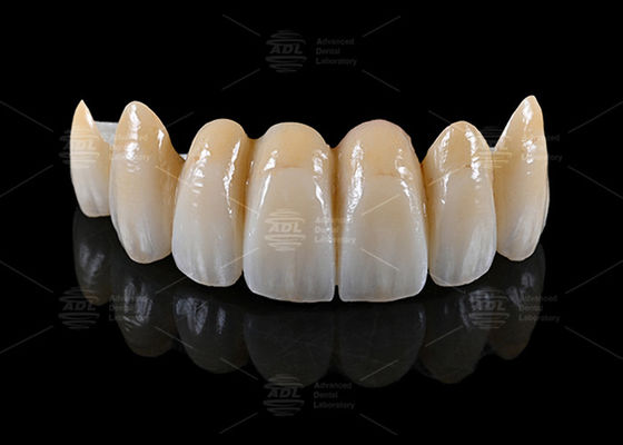 kaufen China Dental Lab zur Verfügung stellt AIDITE ZIRKONIA BLOCK Materialien zusammen mit Turnaround-Zeit in 72 Stunden für die Zahnherstellung Online-Herstellung