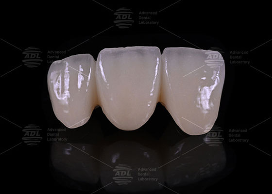 kaufen China Dental Lab Genaue Präzision der Ränder Schicht Zirkonia Hypoallergenisch Biokompatibles Zahnmaterial für langlebige und Restaurationen Online-Herstellung