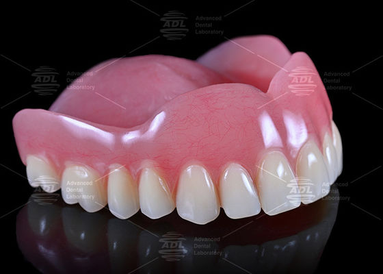 kaufen China Dental Lab hohe Ästhetik kundenspezifische Voll Acryl Zahnersatz Voll Service für weltweit Online-Herstellung
