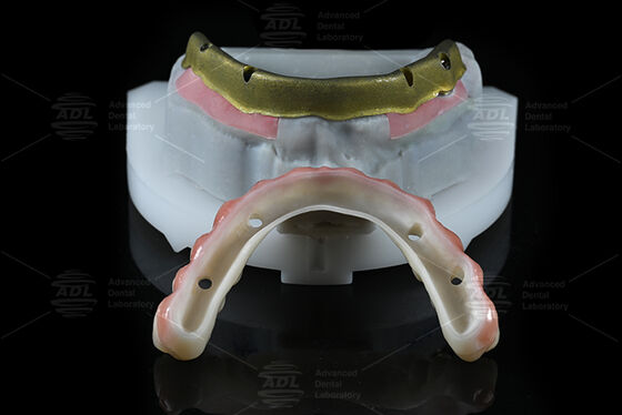 kaufen China Dental Lab Kompatibel mit den meisten Zahnimplantatsystemen Alle auf 4 Angebot in 72 Stunden Bearbeitungszeit und technische Parameter Online-Herstellung