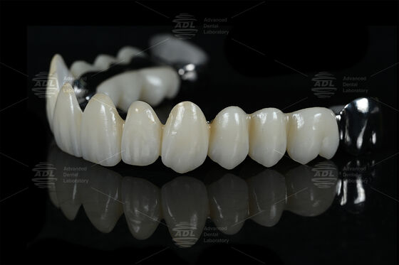 kaufen China Dental Lab Outsourcing Dental Lab Ti Verstärkung Bar mit Vollzirkonium bietet wettbewerbsfähige Preise mit Volumenrabatten zugeschnitten für Zahnärzte, die und Herstellung Online-Herstellung