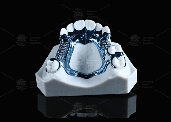 Anodisierte 3D-gedruckte Titan-Rahmen, leicht und geeignet für empfindliche Haut