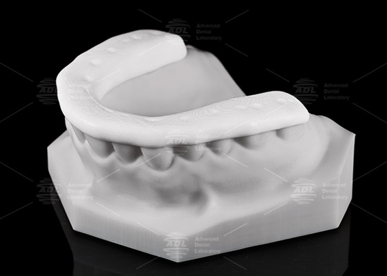 Haltbarkeit und Atmungskraft 3D-gedruckte Nylon-Ocklusalspalte / Nachtschutz für aktive Lebensstile