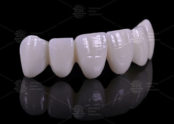 Wettbewerbsfähige Preise mit Mengenrabatten. Dentallabor bietet Zahnprothetik in 16 Farben an, die auf die medizinische Industrie zugeschnitten sind