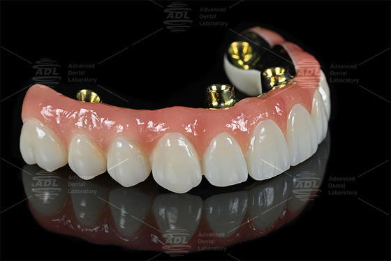 Professionelle Zahntechnik-Outsourcing-Dienstleistungen, die präzise Dentalprothetik und kundenspezifische Lösungen für die Bedürfnisse der Dentalindustrie liefern
