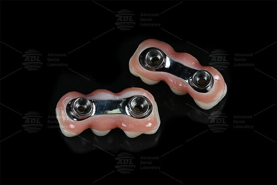 Verstärkung Implantat Bar CAD CAM Konzipiert für die Präzision Fit Kompatibel mit den meisten Zahnimplantat-Systeme Sicherstellung Zahnrestaurierung Lösungen Chinesische Zahnlabor