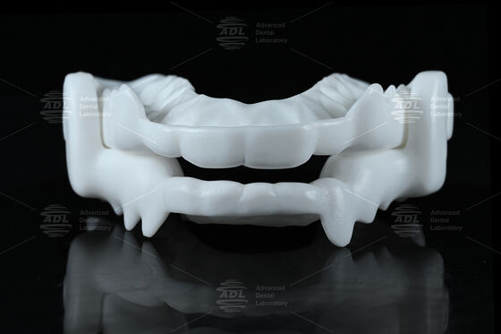 Medizinische Naylon-Ocklusal-Splint-Nachtwache mit flexiblem CAD/CAM-Design zum Schutz vor Bruxismus