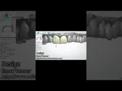 Natürliche Pressen EMAX Veneer Festigkeit 16 Farbtöne Emax Zahn Veneers